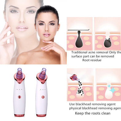 Blackhead Buster! Achieve Flawless Skin with This Pore Vacuum Tool