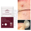 Invisible Acne Stickers Pimple Remover