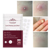 Invisible Acne Stickers Pimple Remover